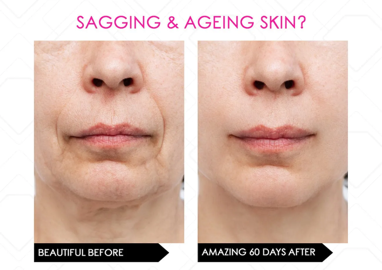 Limited Stock* Skin Secrets Pro Kit Amazing LED Mask - Red Led 7 in 1 Treatments FDA Cleared