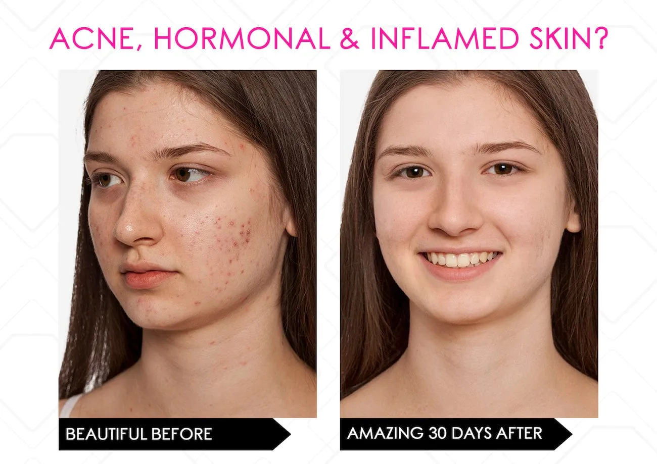 Limited Stock* Skin Secrets Pro Kit Amazing LED Mask - Red Led 7 in 1 Treatments FDA Cleared