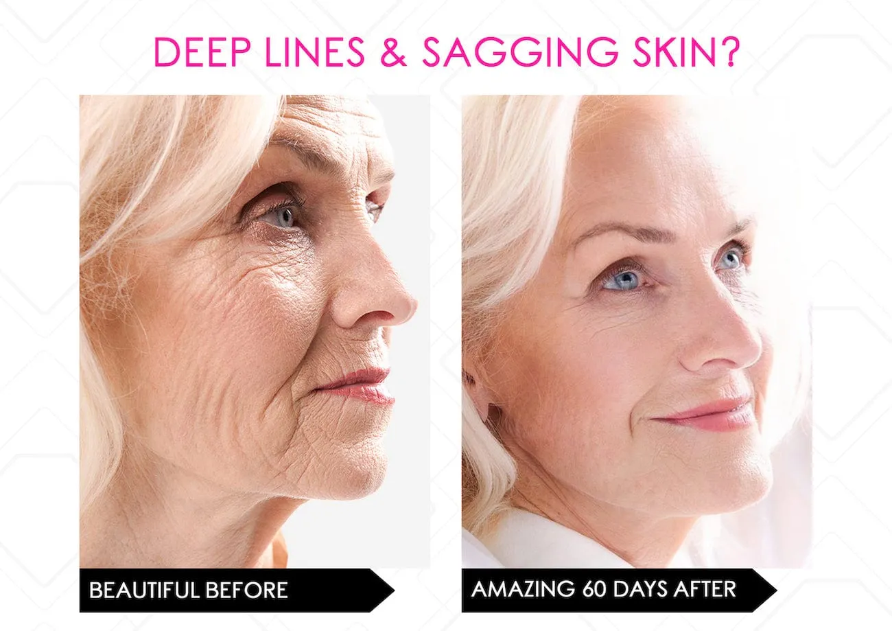 Limited Stock* Skin Secrets Pro Kit Amazing LED Mask - Red Led 7 in 1 Treatments FDA Cleared