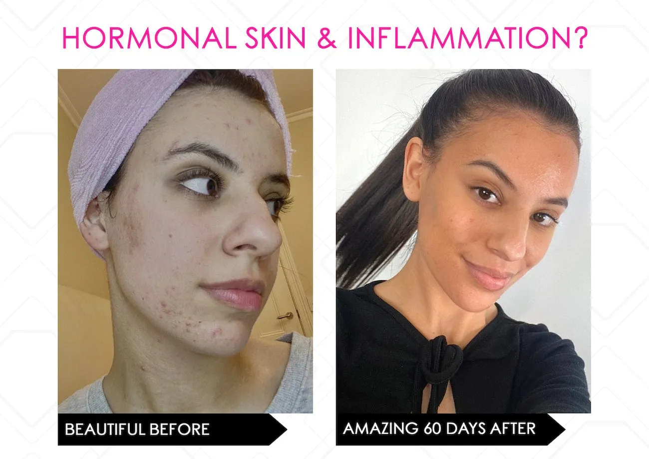 Limited Stock* Skin Secrets Pro Kit Amazing LED Mask - Red Led 7 in 1 Treatments FDA Cleared