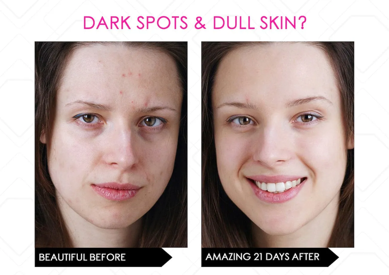 Limited Stock* Skin Secrets Pro Kit Amazing LED Mask - Red Led 7 in 1 Treatments FDA Cleared