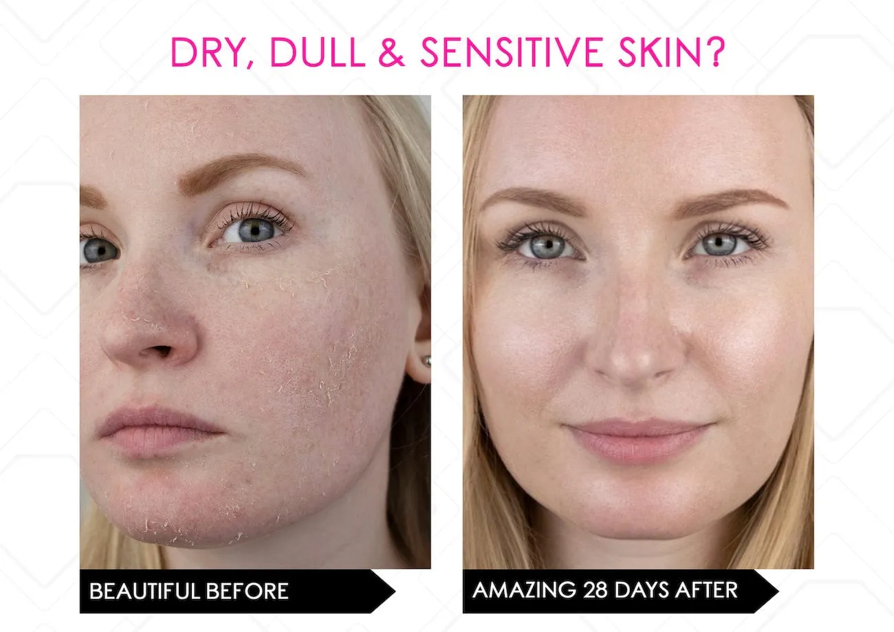 Skin Secrets Amazing Multi Light Therapy IR288 LED Mask FDA Cleared
